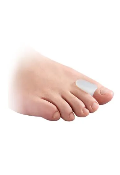 Hallux Valgus의 발가락 구분 기호